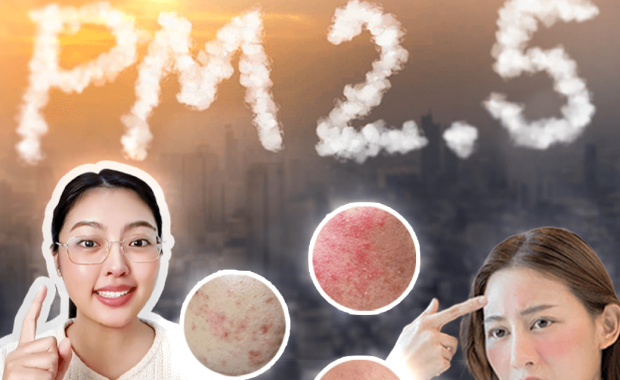 การดูแลผิวให้รอดพ้นจาก PM2.5