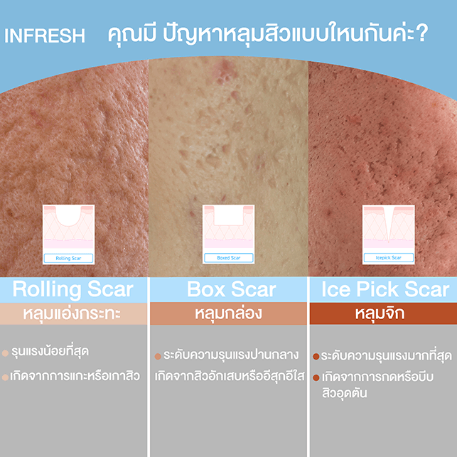 scar 3in1-re-1